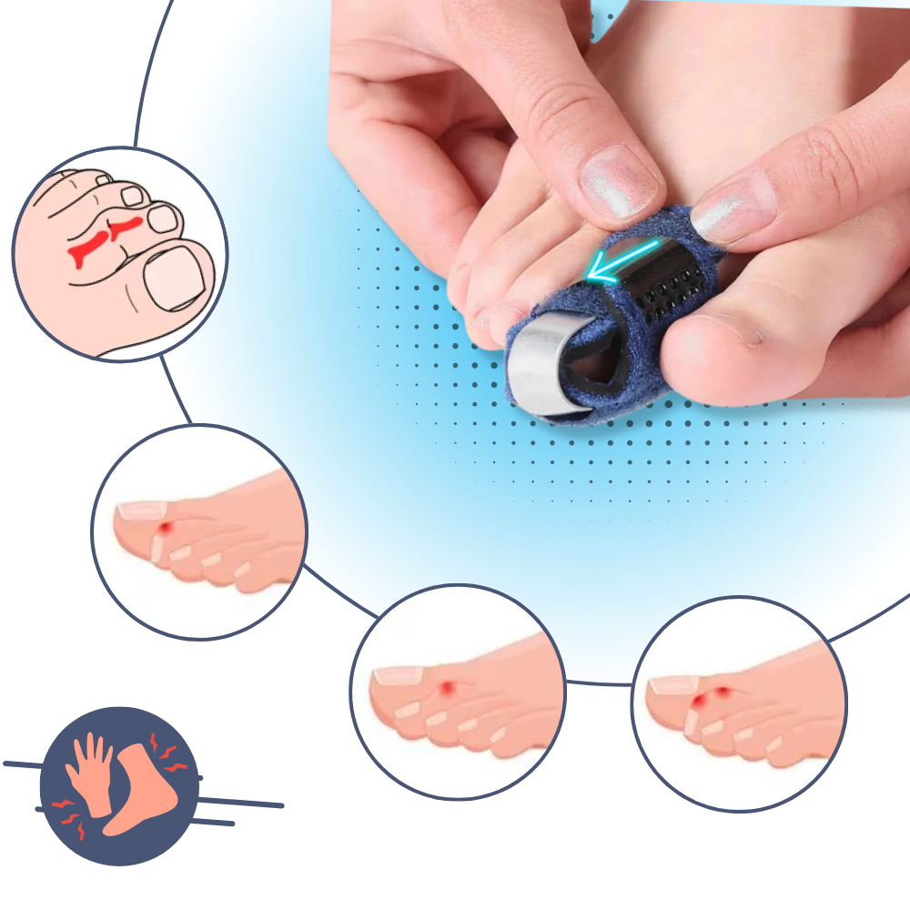 Tåudglatter Med Justerbar og Diskret Pasform - Ozerty