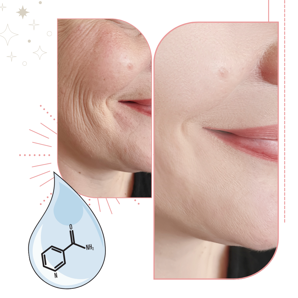 Naturlig virkningsfuld opstrammende creme - Ozerty