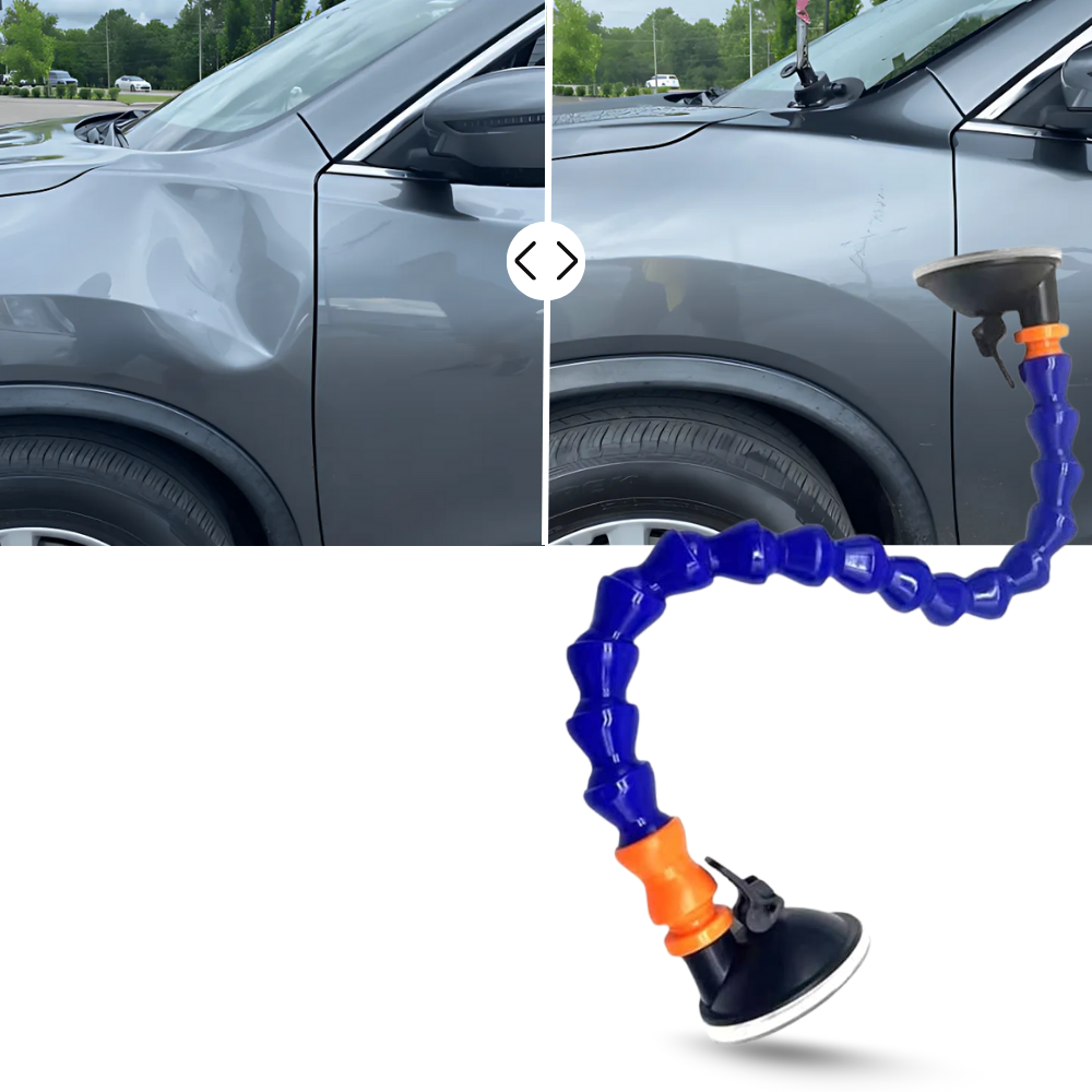 Dent Master Sugekop - Ozerty