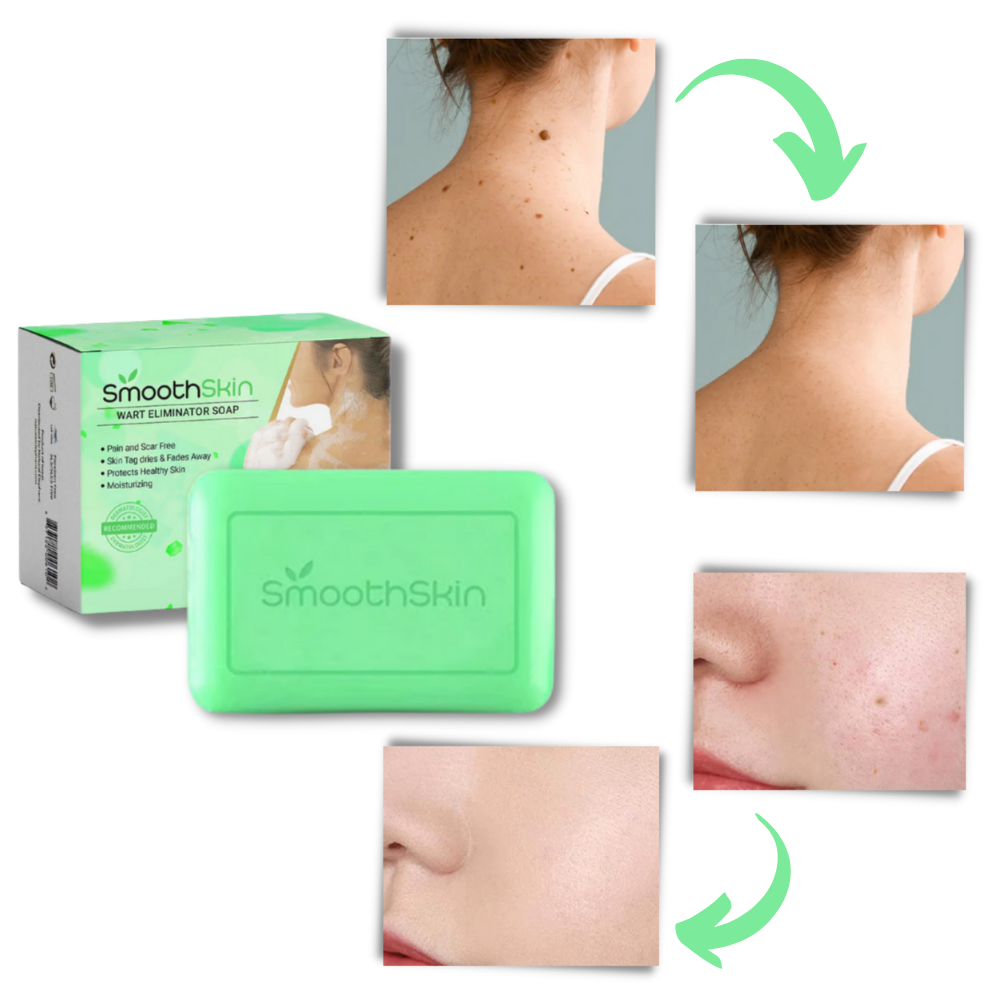 Fugtgivende eksfolieringssæbe til fjernelse af vorter
- Ozerty