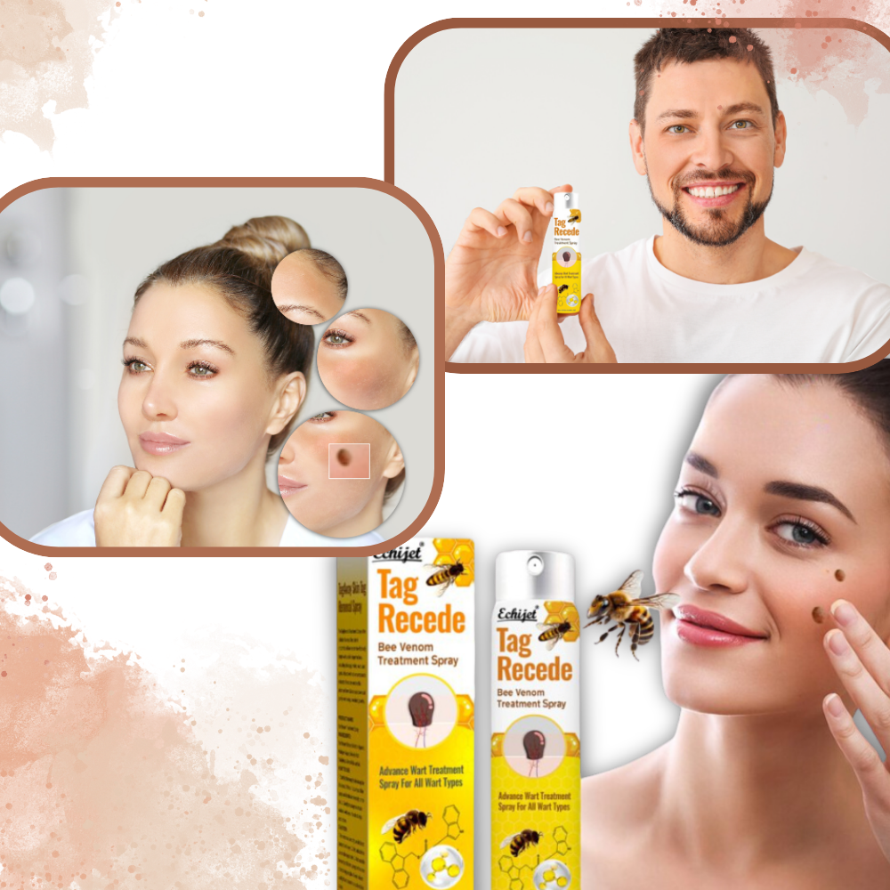 Ikke-invasiv fjernelse af hudmærker - Ozerty