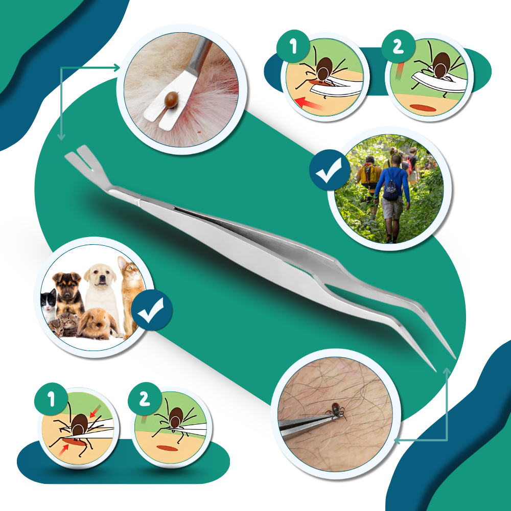 Præcisions Flåt Fjerner - Ozerty