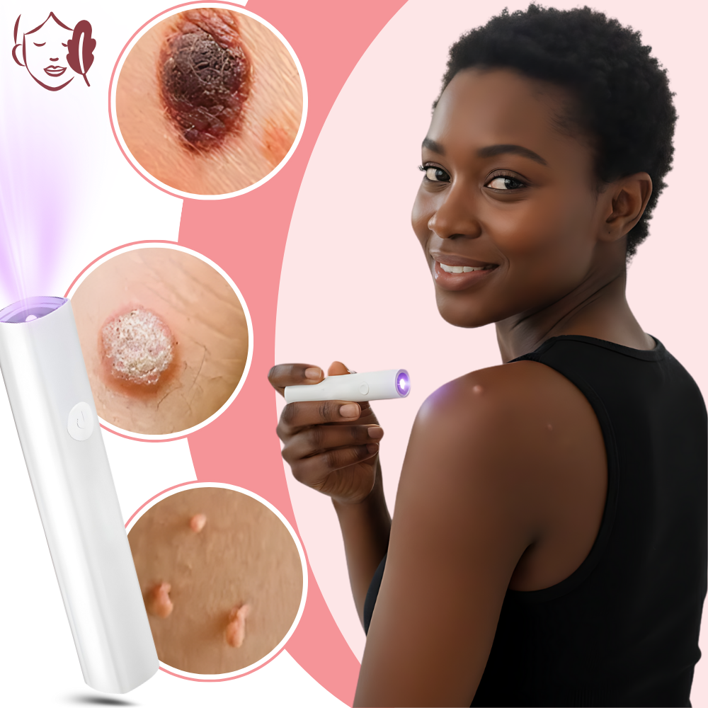 Radiance kosmetisk laserpen - Ozerty