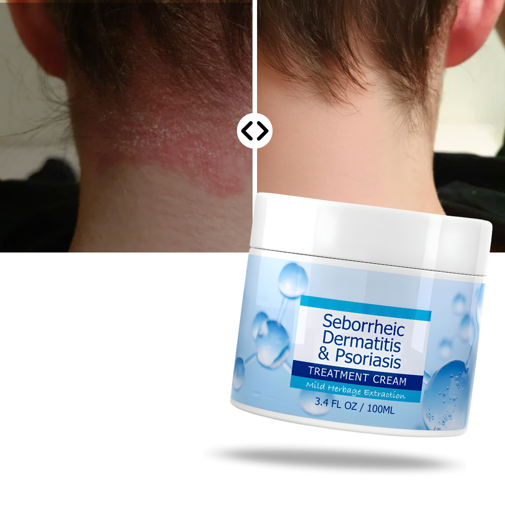 Fugtgivende Creme til Hovedbunden - Ozerty