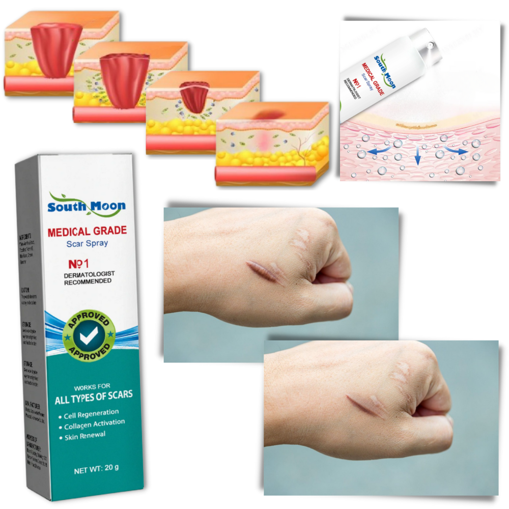 Spraybehandling til fjernelse af ar
- Ozerty