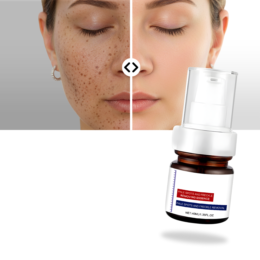 Hudoplysende Silkeagtig Kojic Serum - Ozerty