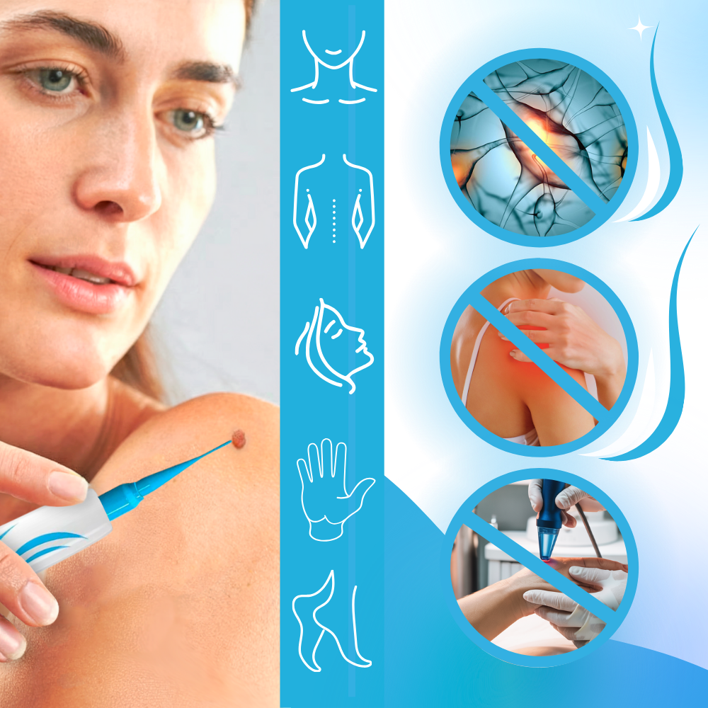 Hudlap Fjerner Pro - Ozerty