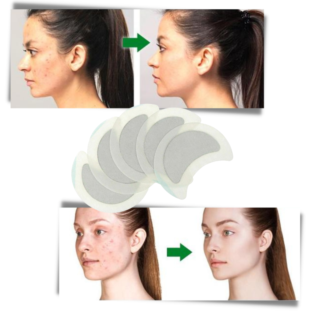 5 x anti-sved urte lymfeplaster - Ozerty