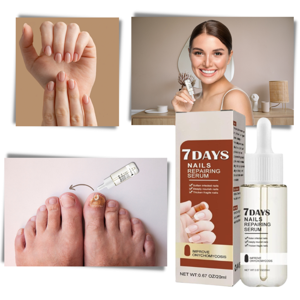 7 Dages Essens til genoprettelse af negle - Ozerty