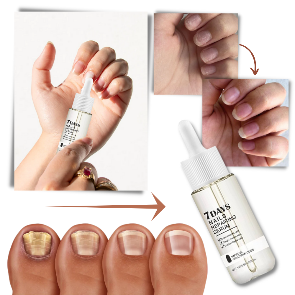 7 Dages Essens til genoprettelse af negle - Ozerty