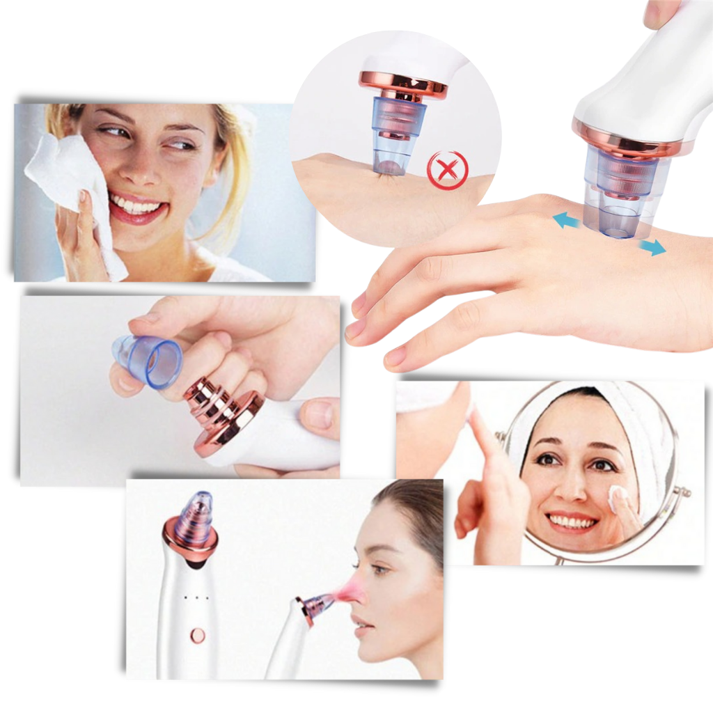 Blackhead pore renser - Ozerty