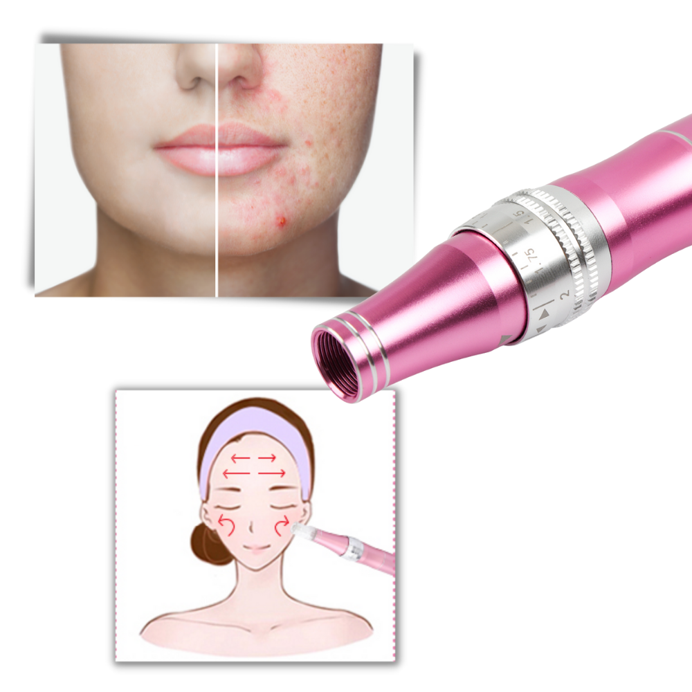 Dermal Micro-needling pen - Ozerty