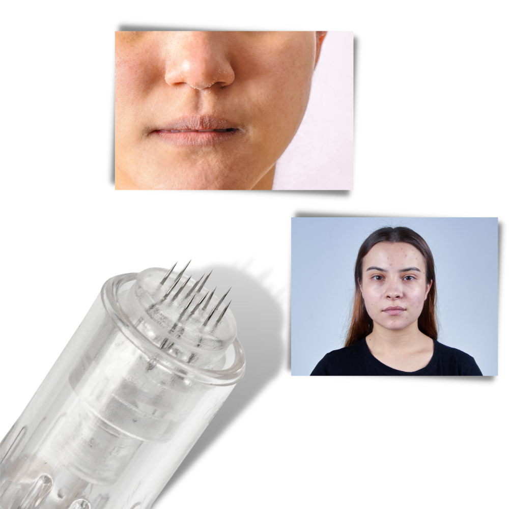 Dermal Micro-needling pen - Ozerty