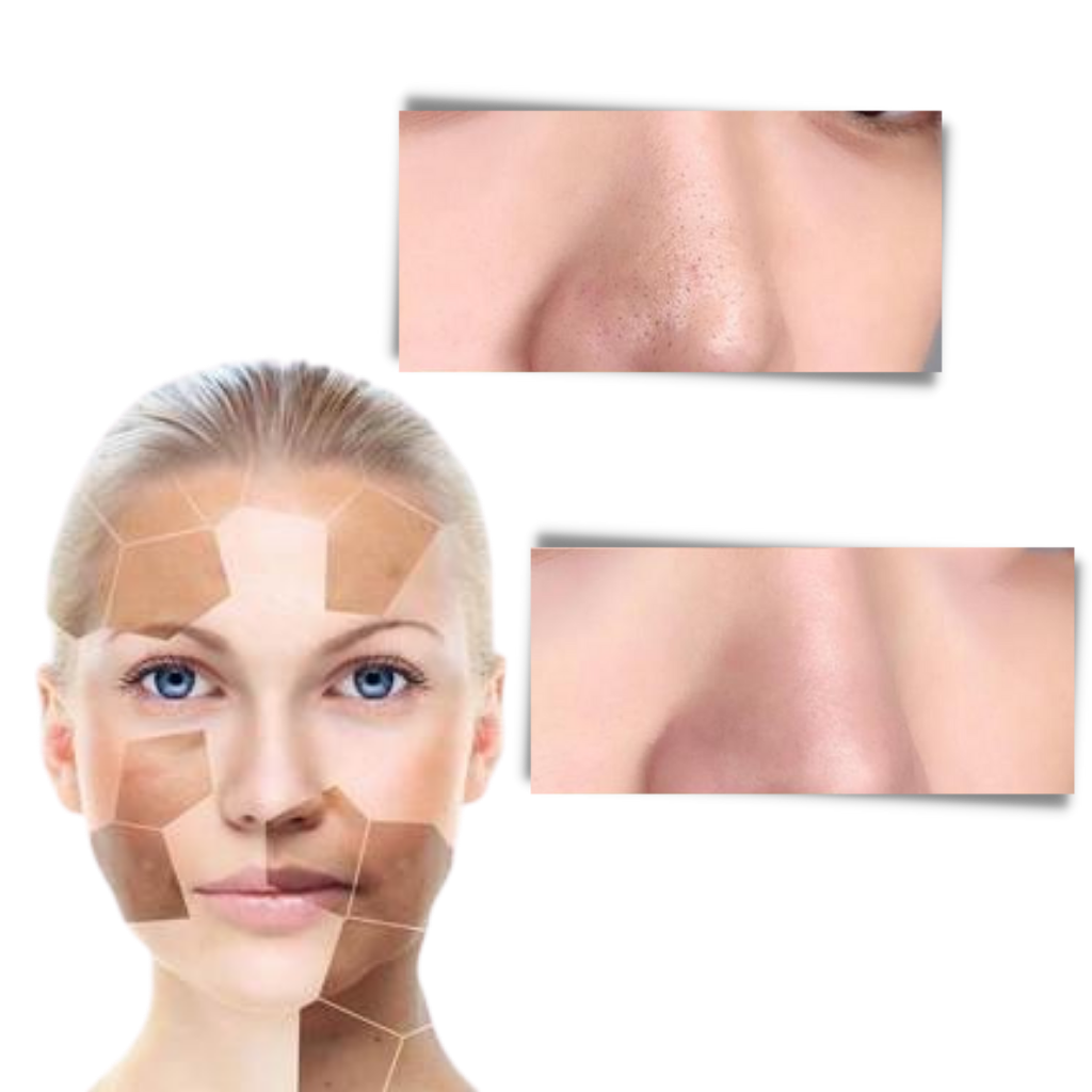 Fri for porer dyb udrensning fjernelse af hudorme grøn te maske - Ozerty