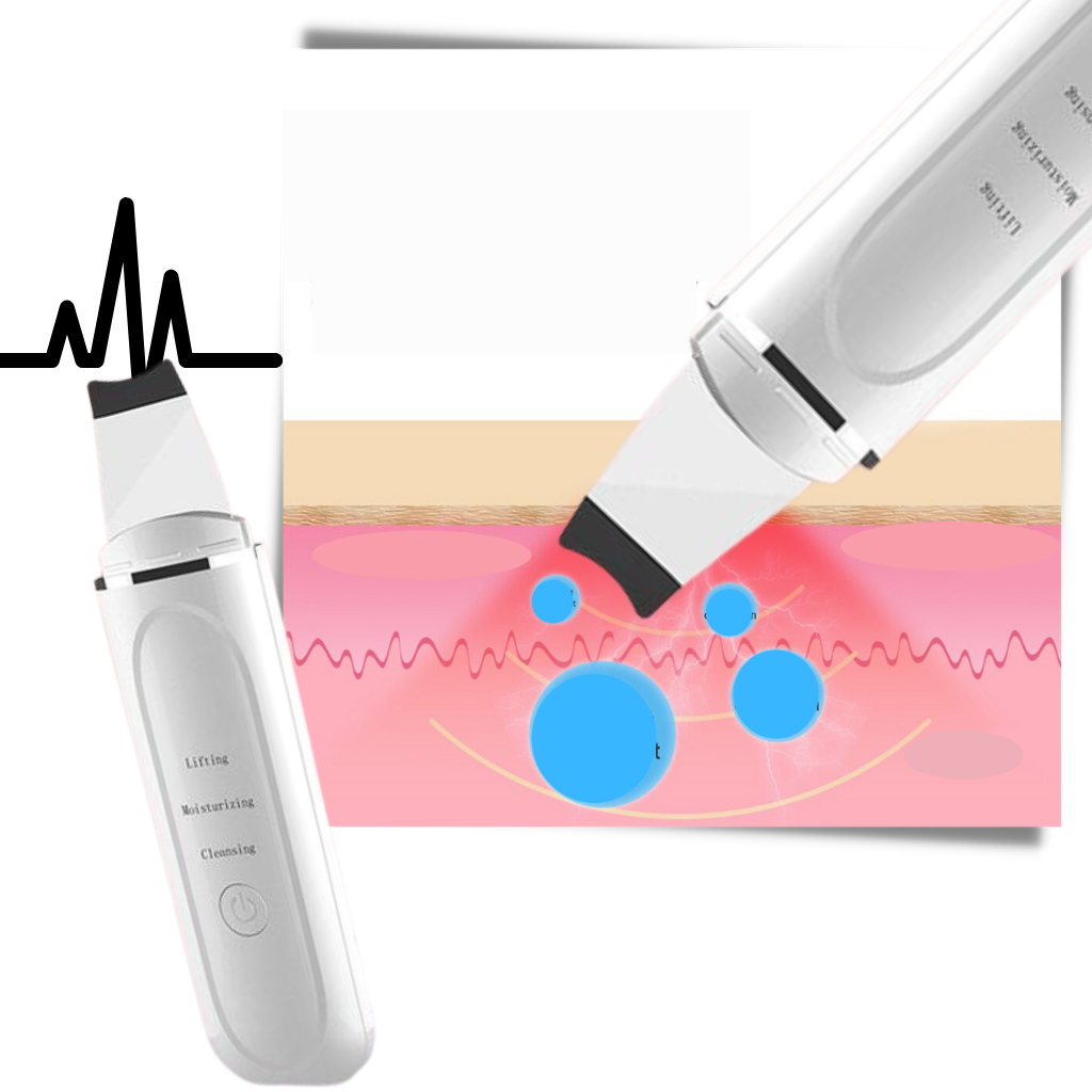 Ultrasonisk dybderensende ansigtsskrubber - Ozerty