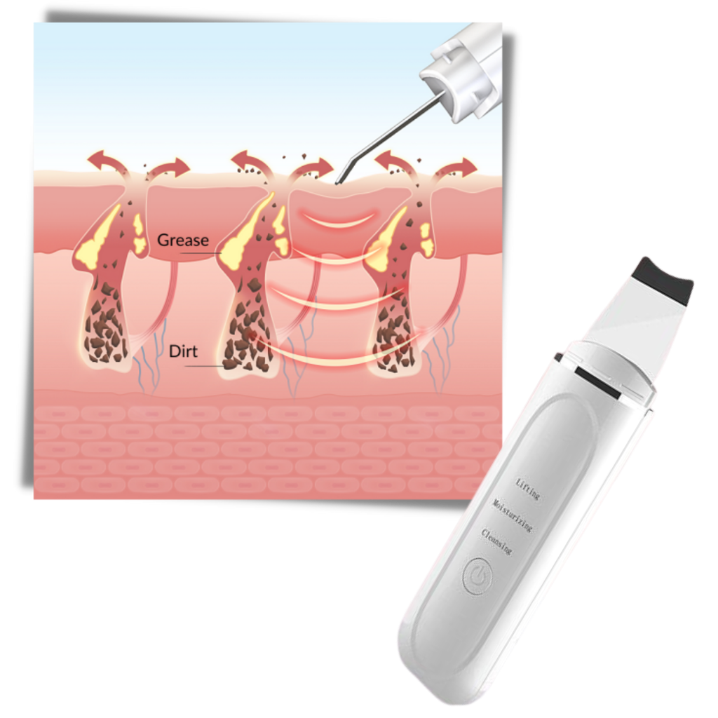 Ultrasonisk dybderensende ansigtsskrubber - Ozerty