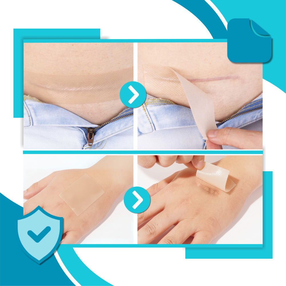 Hyaluronsyre Silikone Arplaster - Ozerty