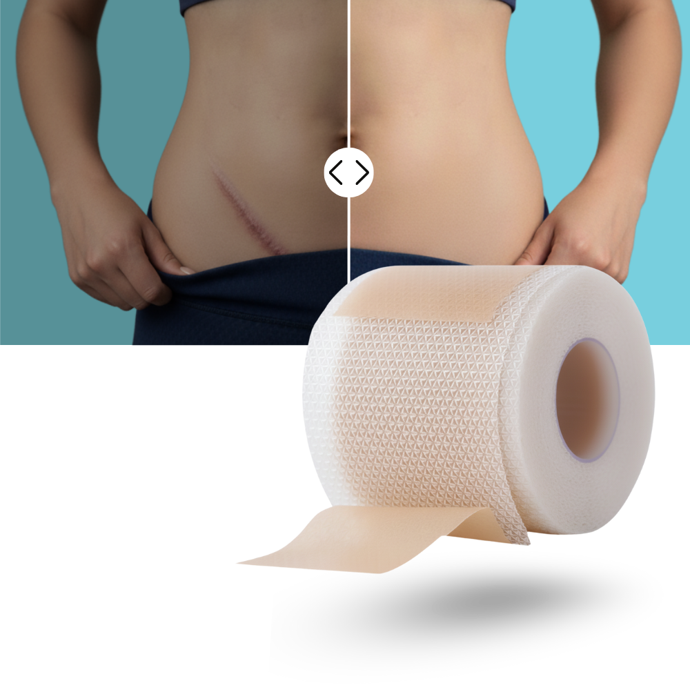 Hyaluronsyre Silikone Arplaster