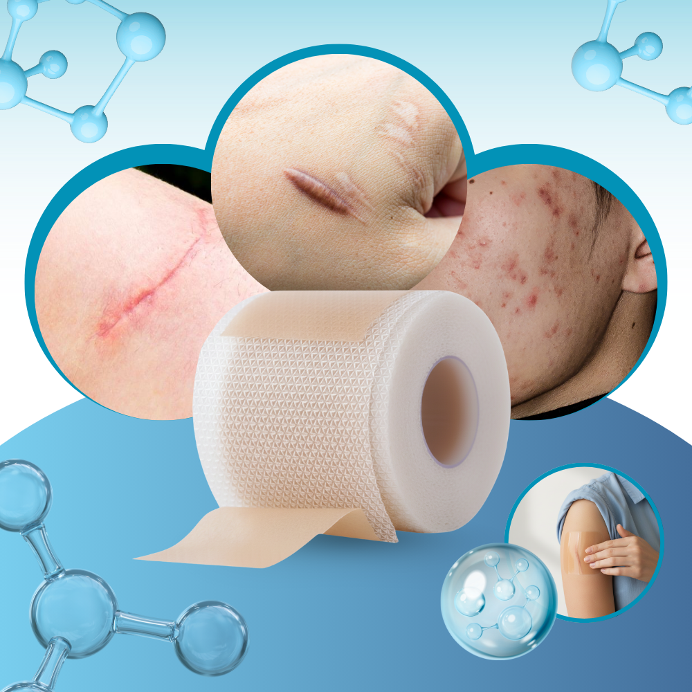 Hyaluronsyre Silikone Arplaster - Ozerty