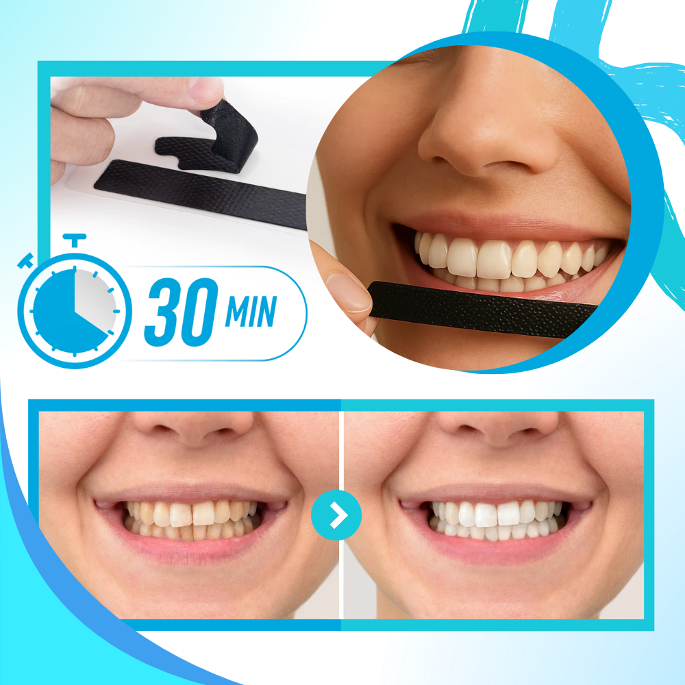 Minty Charcoal Tandblegningsstrips - Ozerty