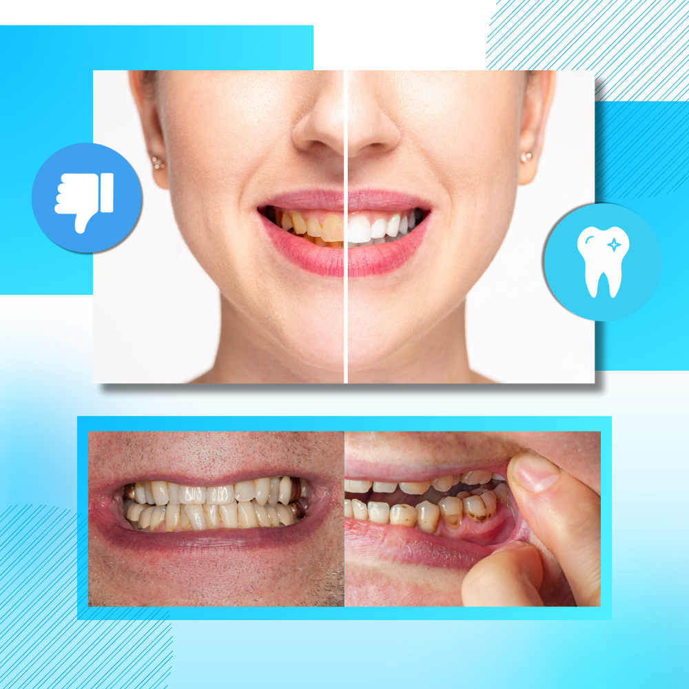 Minty Charcoal Tandblegningsstrips - Ozerty