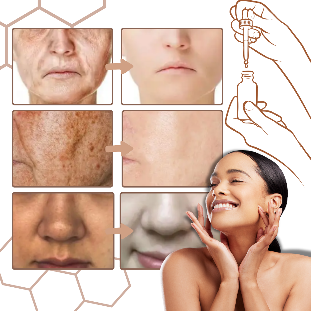 Ikke-fedtet melanin-korrigerende ansigtsserum - Ozerty