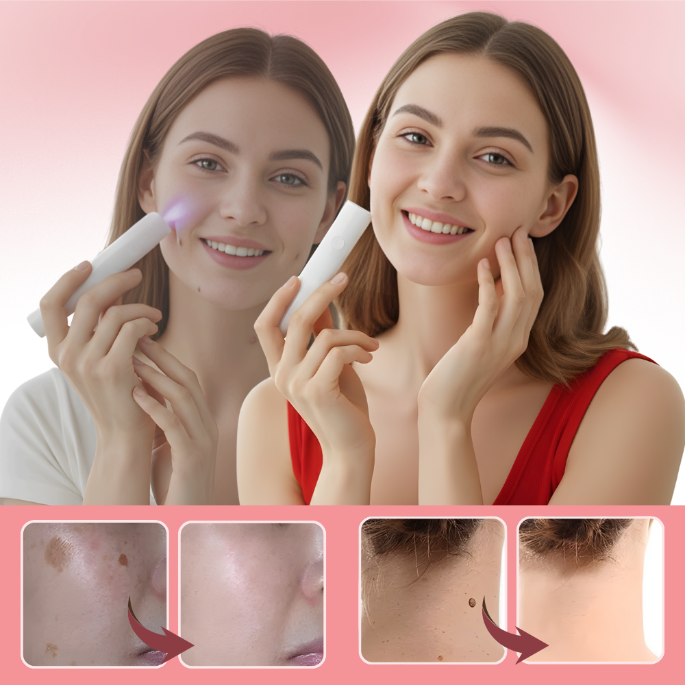 Radiance kosmetisk laserpen - Ozerty