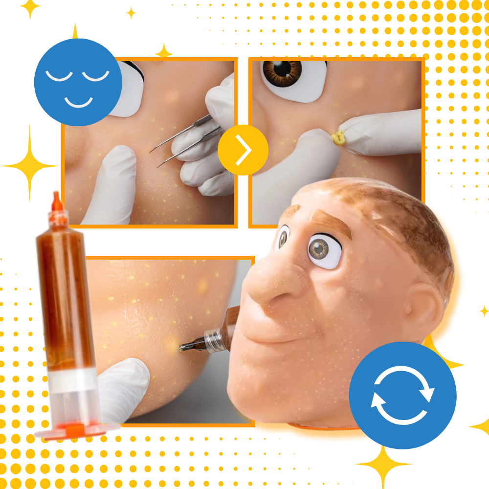 Afslappende Bumseklemmer i Silikone - Ozerty