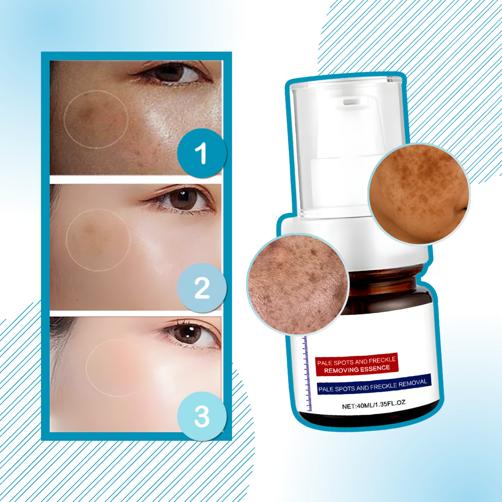 Hudoplysende Silkeagtig Kojic Serum - Ozerty