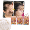 Solid risshampoo- og balsambar - Ozerty