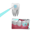 Maskine til dybderensning af tandsten - Ozerty